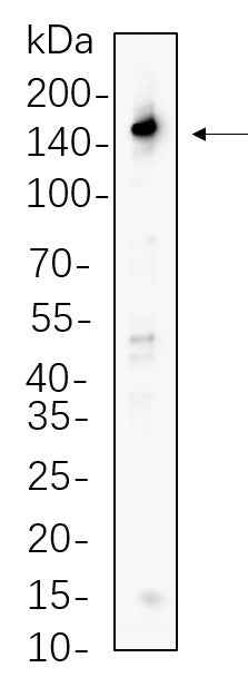 Anti-Human/Mouse/Rat PLC γ1 Antibody [B608] - ABMIUM