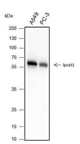 Anti-Human LPCAT1 Antibody [A287]