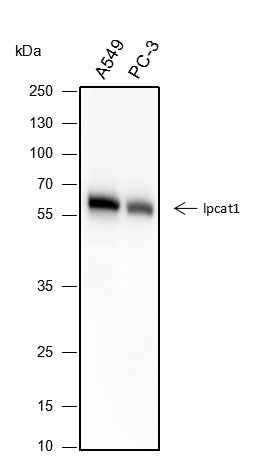 Anti-Human LPCAT1 Antibody [A287]