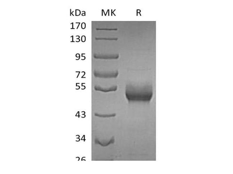 Recombinant Human B4GALT1 (C-6His) - ABMIUM