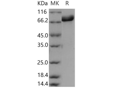 Recombinant Human DBH/Dopamine beta-Hydroxylase Protein (His Tag) - ABMIUM