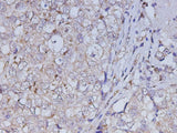 Anti-Human ABL1 Antibody - ABMIUM