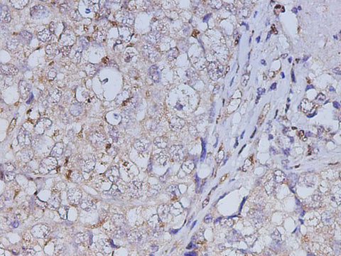 Anti-Human ABL1 Antibody - ABMIUM