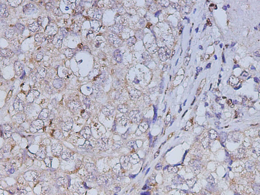 Anti-Human ABL1 Antibody - ABMIUM