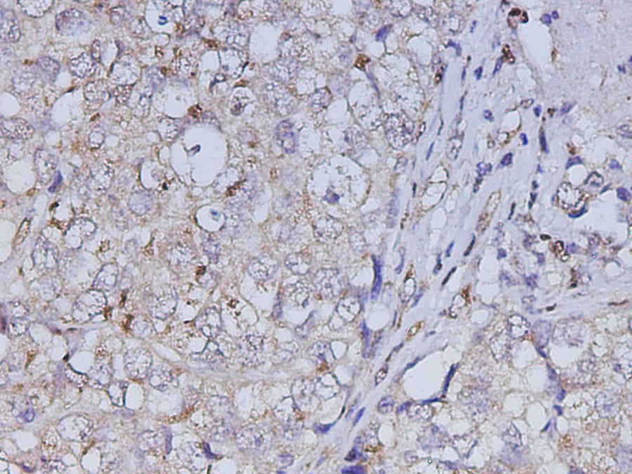 Anti-Human ABL1 Antibody - ABMIUM