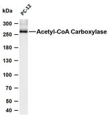 Anti-Human/Mouse/Rat Acetyl Coenzyme A Carboxylase beta Antibody [B753]