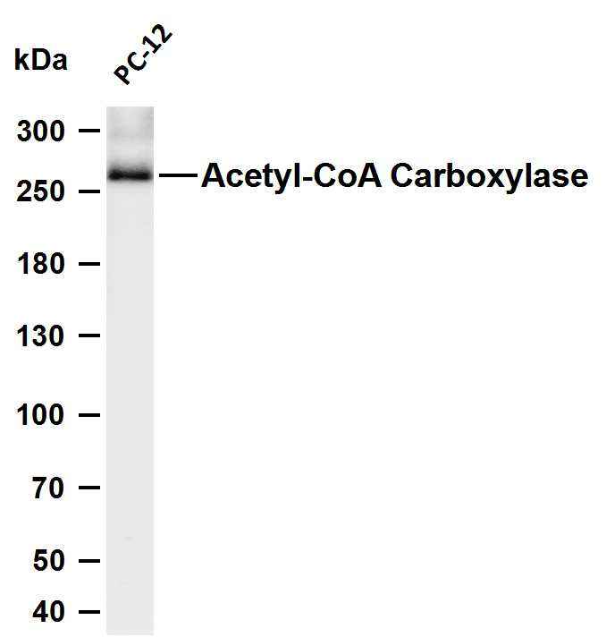 Anti-Human/Mouse/Rat Acetyl Coenzyme A Carboxylase beta Antibody [B753] - ABMIUM