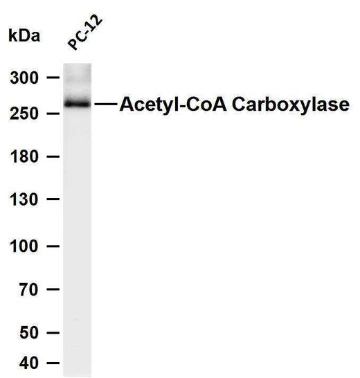 Anti-Human/Mouse/Rat Acetyl Coenzyme A Carboxylase beta Antibody [B753] - ABMIUM
