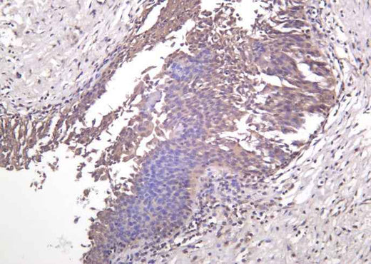 Anti-Human/Mouse/Rat MEK-7 Antibody [B1029] - ABMIUM