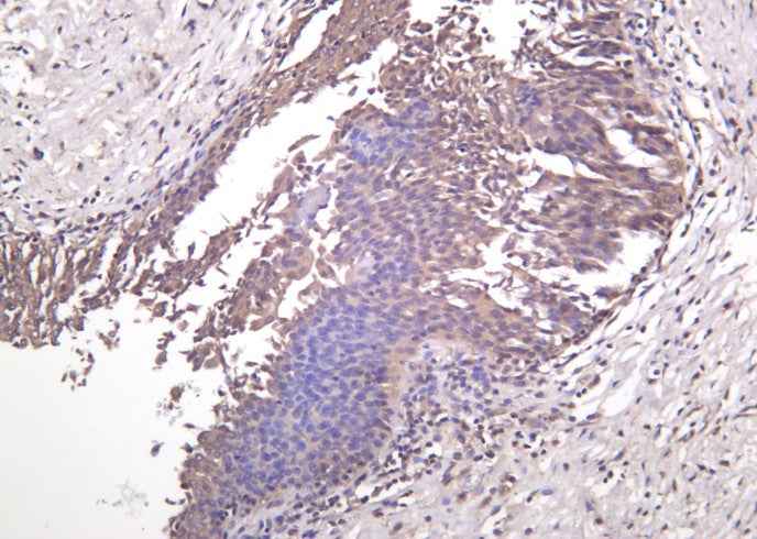 Anti-Human/Mouse/Rat MEK-7 Antibody [B1029]