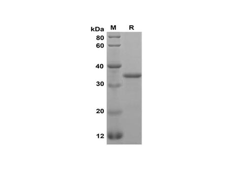 SDS-PAGE analysis of Mouse Betacellulin/BTC proteins, 2 μg/lane of Recombinant Mouse Betacellulin/BTC proteins was resolved with SDS-PAGE under reducing conditions, showing bands at 35 kDa.