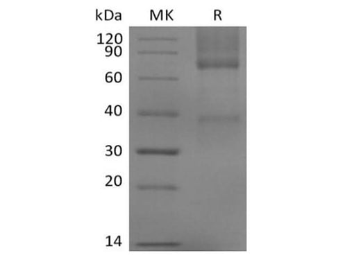 Recombinant Mouse Glypican-3/GPC3/OCI5 (C-6His) - ABMIUM