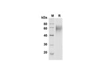 SDS-PAGE analysis of Human DR6/TNFRSF21 proteins , 2 μg/lane of Recombinant Human DR6/TNFRSF21 proteins was resolved with SDS-PAGE under reducing conditions , showing bands at 60 kDa.