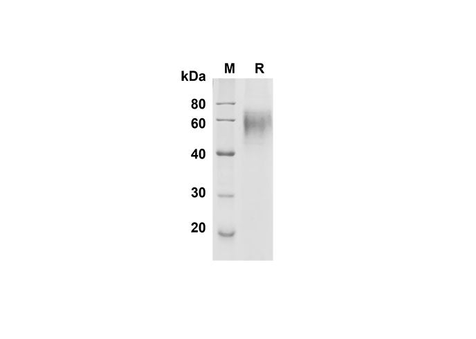 SDS-PAGE analysis of Human DR6/TNFRSF21 proteins , 2 μg/lane of Recombinant Human DR6/TNFRSF21 proteins was resolved with SDS-PAGE under reducing conditions , showing bands at 60 kDa.