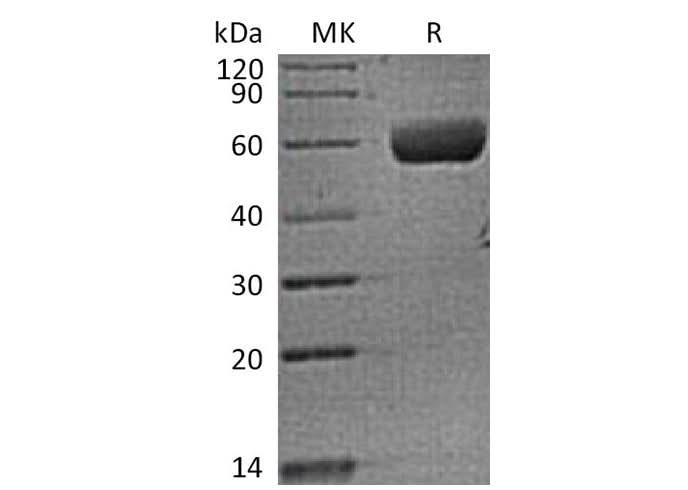 Recombinant Human FAM3B (C-Fc) - ABMIUM