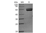 Recombinant Human FAM3B (C-Fc) - ABMIUM