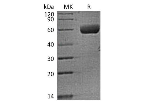 Recombinant Human FAM3B (C-Fc) - ABMIUM