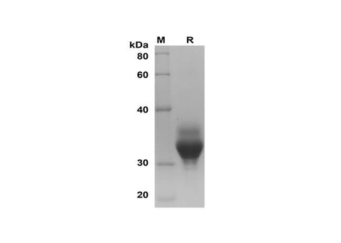 SDS-PAGE analysis of Human OLR1/LOX-1 proteins, 2 μg/lane of Recombinant Human OLR1/LOX-1 proteins was resolved with SDS-PAGE under reducing conditions, showing bands at 32 kDa.