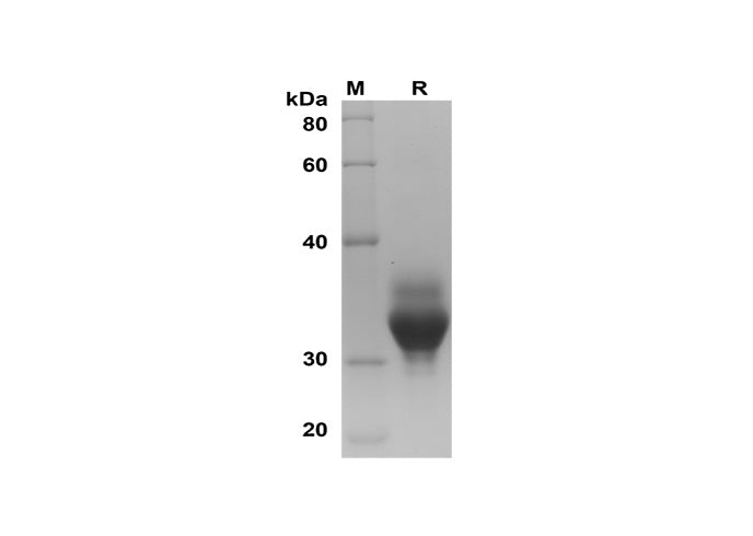 SDS-PAGE analysis of Human OLR1/LOX-1 proteins, 2 μg/lane of Recombinant Human OLR1/LOX-1 proteins was resolved with SDS-PAGE under reducing conditions, showing bands at 32 kDa.