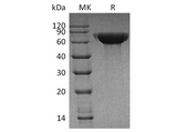 Recombinant Human CNDP1 Protein (His Tag) - ABMIUM