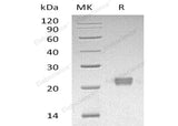 Recombinant Human ITPase/ITPA Protein (His Tag) - ABMIUM