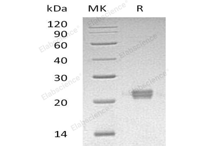 Recombinant Human ITPase/ITPA Protein (His Tag) - ABMIUM