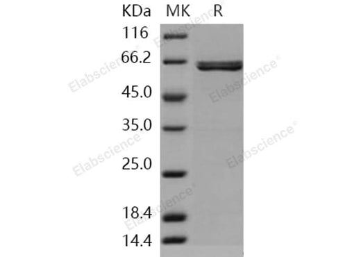 Recombinant Human AIM2 Protein (GST Tag) - ABMIUM