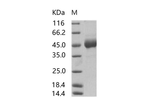 Recombinant EBOV (Subtype Sudan, strain Gulu) Glycoprotein / GP1 (mucin domain deleted) Protein (His Tag) - ABMIUM