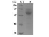 Recombinant Human Tyrosine-protein kinase receptor UFO/AXL oncogene/UFO (C-6His) - ABMIUM