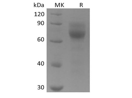 Recombinant Human Tyrosine-protein kinase receptor UFO/AXL oncogene/UFO (C-6His) - ABMIUM