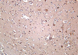 Anti-Human/Mouse/Rat OPA1 Antibody [B1028]