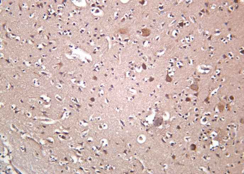 Anti-Human/Mouse/Rat OPA1 Antibody [B1028] - ABMIUM