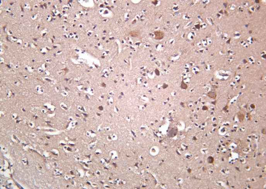 Anti-Human/Mouse/Rat OPA1 Antibody [B1028] - ABMIUM