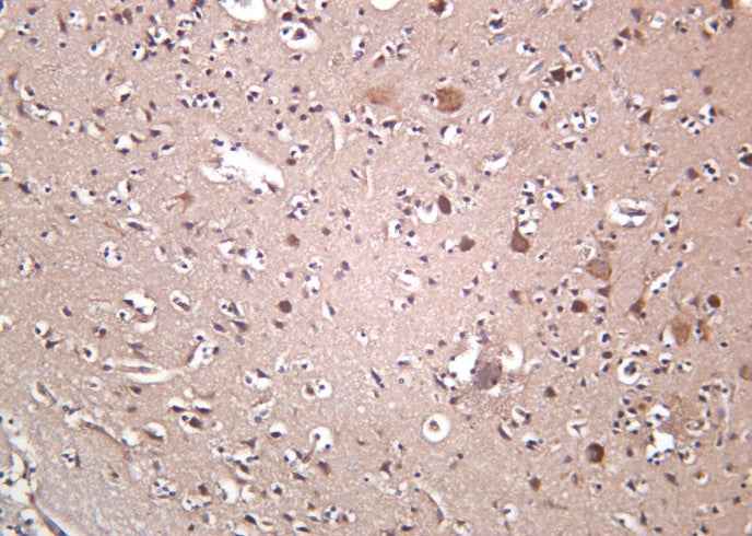 Anti-Human/Mouse/Rat OPA1 Antibody [B1028]