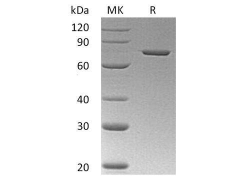 Recombinant Human Annexin A6/ANXA6 Protein (His Tag) - ABMIUM