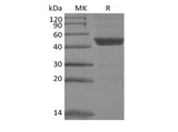 Recombinant Mouse IL-11RA (C-6His) - ABMIUM