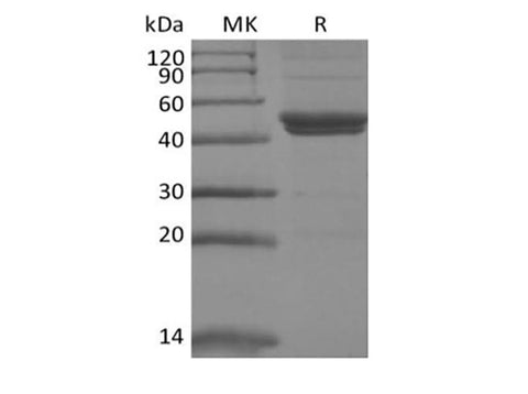 Recombinant Mouse IL-11RA (C-6His) - ABMIUM