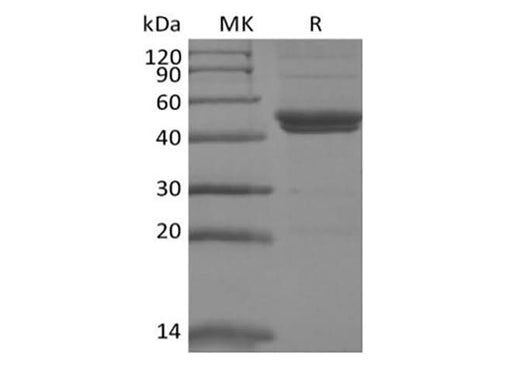 Recombinant Mouse IL-11RA (C-6His) - ABMIUM