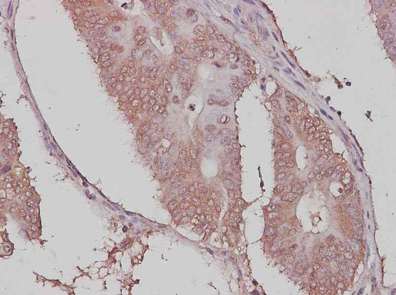 Anti-Human/Rat Ubiquitin Antibody - ABMIUM