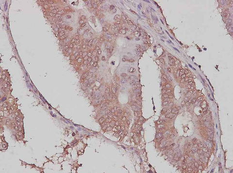 Anti-Human/Rat Ubiquitin Antibody - ABMIUM