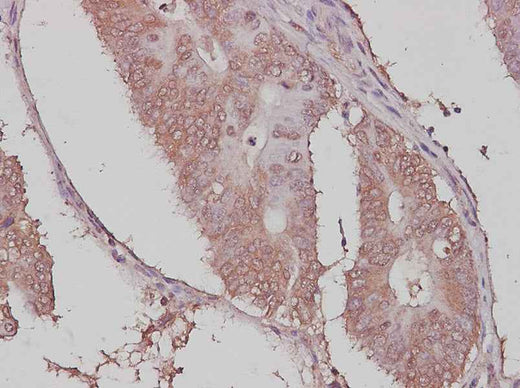 Anti-Human/Rat Ubiquitin Antibody - ABMIUM