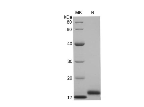 SDS-PAGE analysis of Human CD59 glycoprotein proteins, 2 μg/lane of Recombinant Human CD59 glycoprotein proteins was resolved with SDS-PAGE under reducing conditions, showing bands at 14-16 kDa.