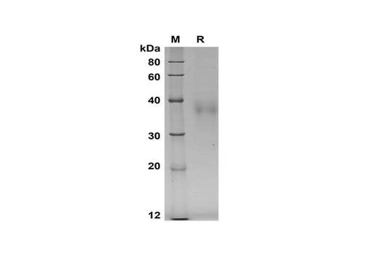 SDS-PAGE analysis of Mouse CD27 proteins, 2 μg/lane of Recombinant Mouse CD27 proteins was resolved with SDS-PAGE under reducing conditions, showing bands at 35-40 kDa.