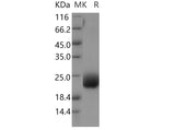Recombinant Human CCDC47 Protein (His Tag) - ABMIUM