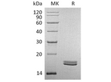 Recombinant Human CD40L/TNFSF5 Protein (Human Cells) - ABMIUM