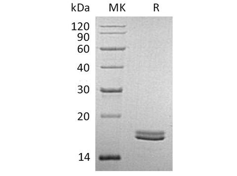 Recombinant Human CD40L/TNFSF5 Protein (Human Cells) - ABMIUM
