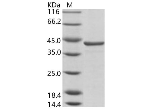 Recombinant HCV (HCV-1a) NS3 protease / helicase immunodominant region Protein (aa 1356-1459, GST Tag) - ABMIUM
