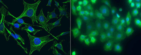 Anti-Human S100A5 Antibody [A1059] - ABMIUM