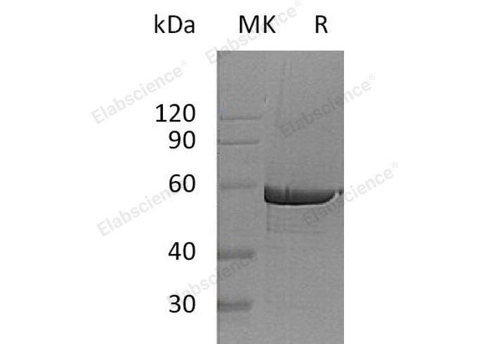Recombinant Human G6PD Protein (His Tag) - ABMIUM
