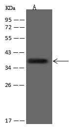 Anti-Human MS4A1 Antibody [A1048] - ABMIUM